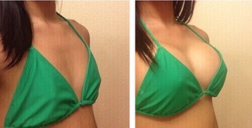 Diagram illustrating the product's effect on firmness and structure.