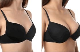 Diagram illustrating the product's effect on firmness and structure.